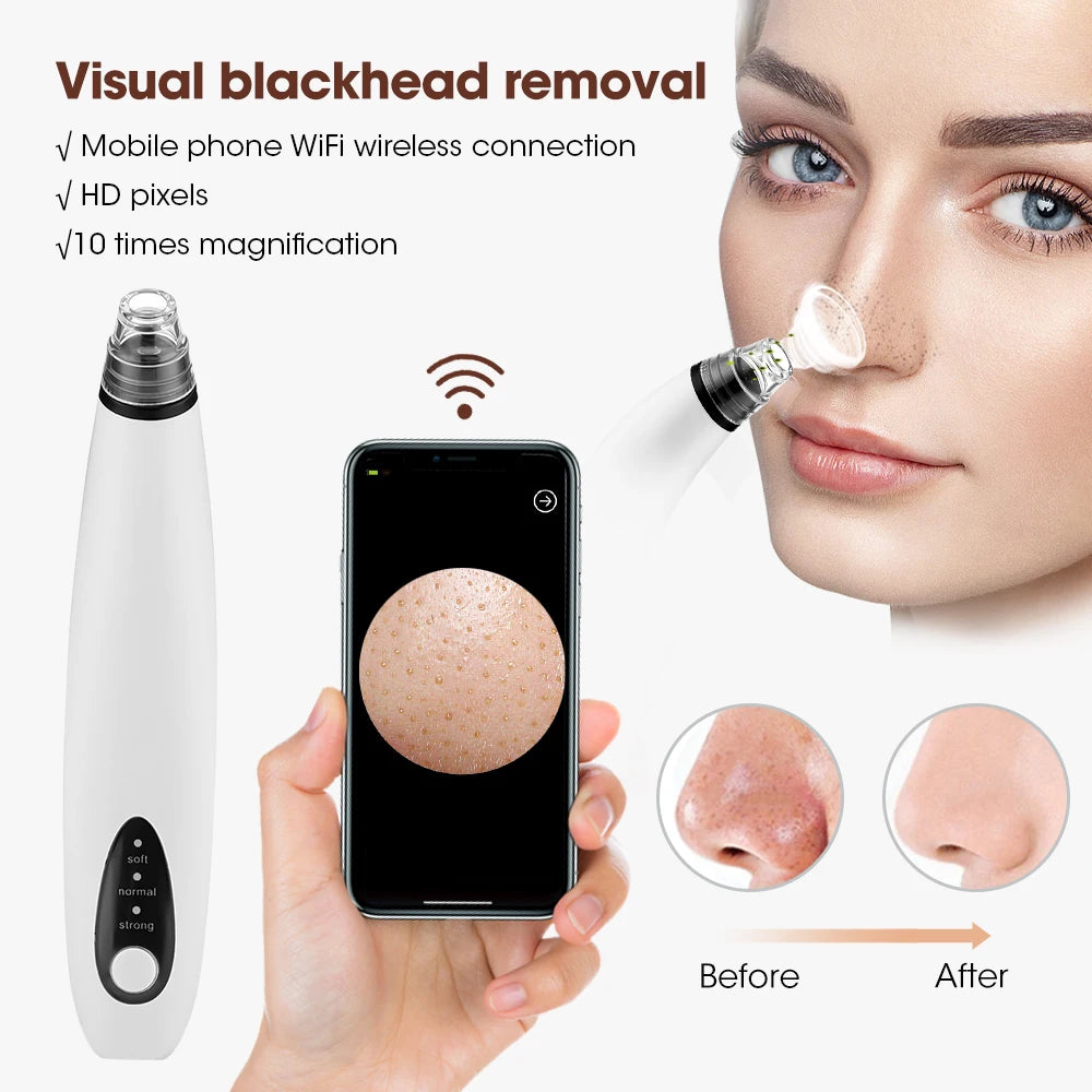 HD Pore Vacuum