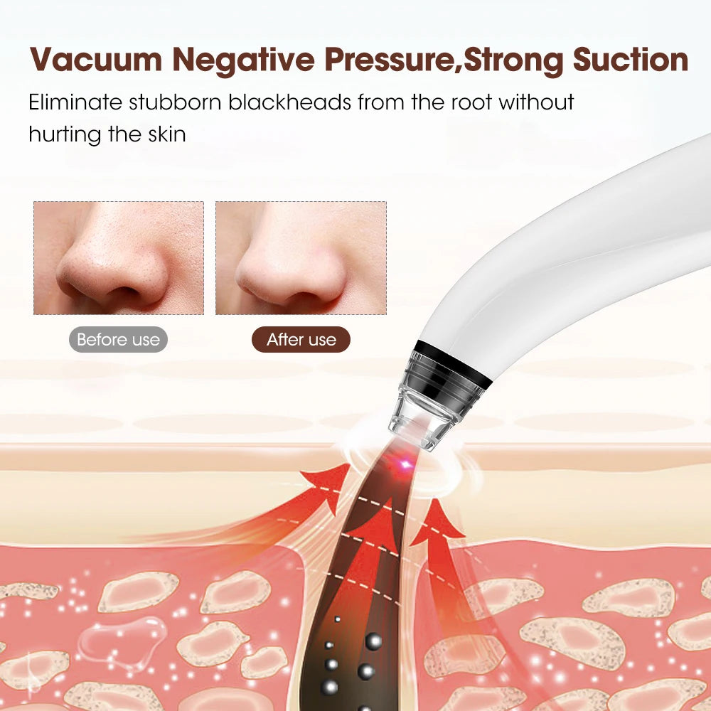 HD Pore Vacuum